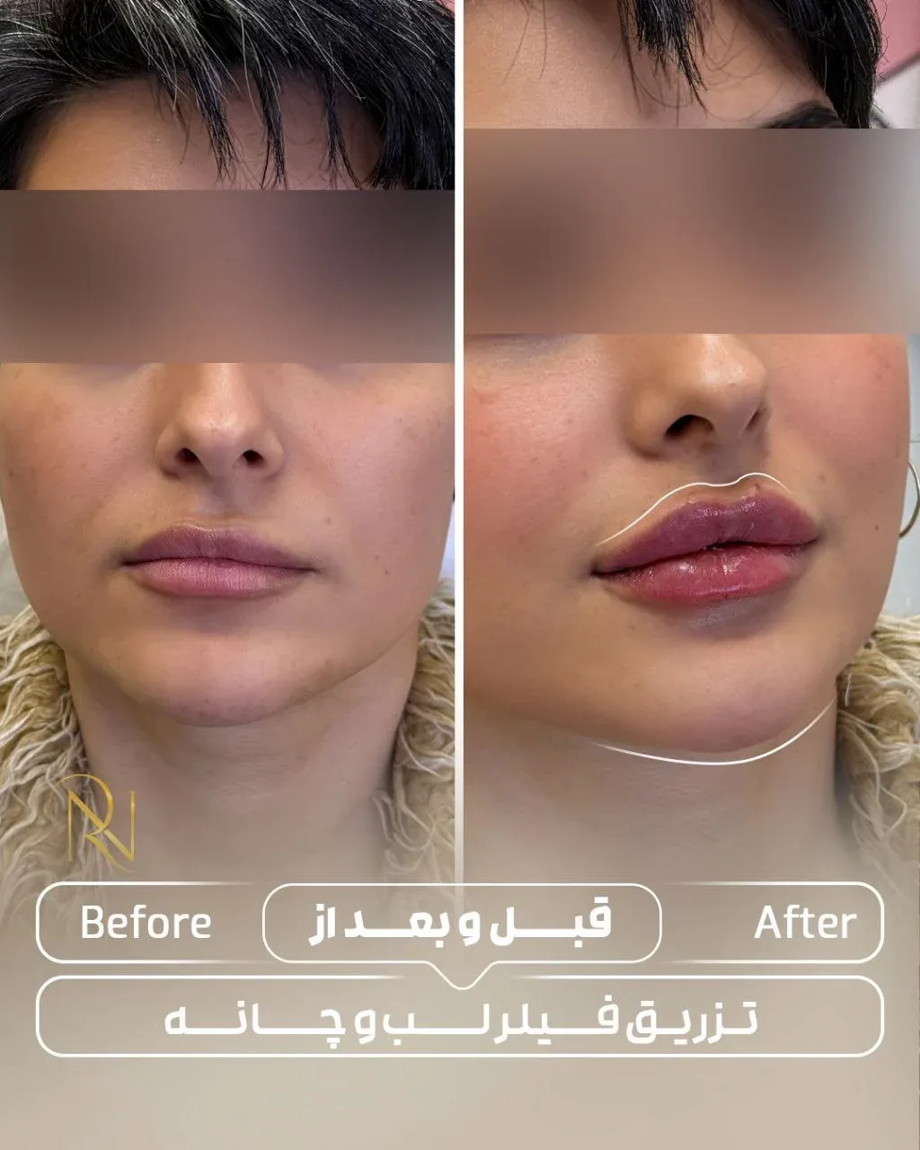 Noorarose.beautyhouse مرکز لیزر و لاغری نورارز پردیس 4