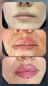 کلینیک زیبایی شری 5