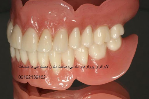 لابراتوار دندانسازی ثامن دندان مصنوعی ژله ای جایگزین ایمپلنت نایتگارد محافظ لثه گیر لثه بند رزمی نایت گارد اوردنچر بیواسطه