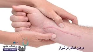 کلینیک درمان زخم و اِسکار