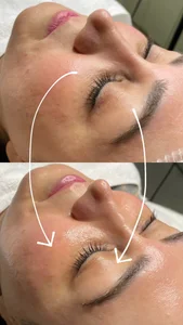 خدمات پاکسازی پوست و فیشال آرمی 3