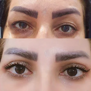 کلینیک زیبایی اترس بیوتی