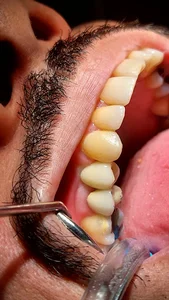 دندانپزشکی دکتر علی محمودی
