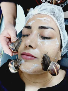 خدمات تخصصی فیشال و حلزون تراپی سعیده 2