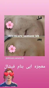 پاکسازی تخصصی پوست 2