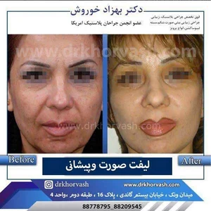 کلینیک زیبایی شمال تهران