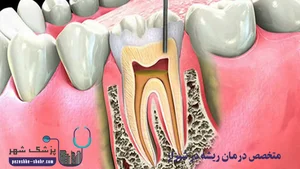 دكتر صابر خزاعي، متخصص درمان ريشه
