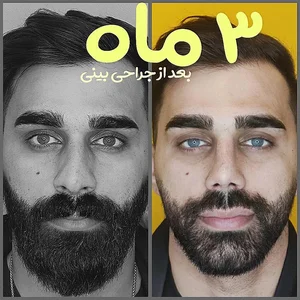 کلینیک زیبایی دکتر خلیل طلایی زاده 2