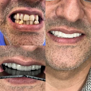 دندانپزشکی لبخند 5