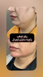 مطب دکتر نیما دهباشی 2
