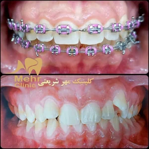کلینیک دندانپزشکی مهر شریعتی 5
