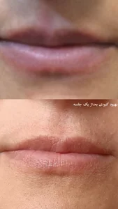 مرکز میکروبلیدینگ تخصصی(صادقی) 2