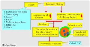 Disseminated Intravascular Coagulopathy (DIC), Diagnosis...