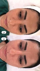 مرکز فیشیال مهدیه اسکین 3