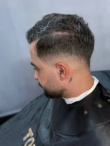 پیرایش اکسون