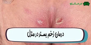 درمان زخم بهشت
