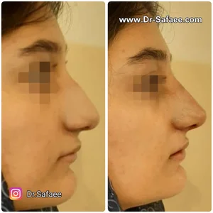 کلینیک زیبایی و کاشت مو دکترحسین صفائی 4