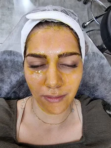 پاکسازی پوست(فیشال) مرجان آرا