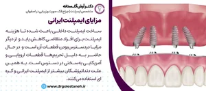 مرکز کاشت و ایمپلنت دندان اسمایل هوم کلینیک