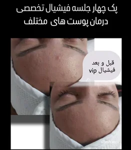 کلینیک و آموزشگاه فیشیال و پاکسازی تخصصی پوست با مدرک بین المللی