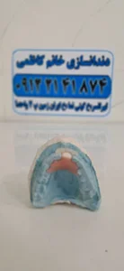 دندانسازی کاظمی