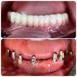 دندانپزشکی دکتر پدرام عبداله زاده 5