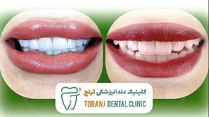 کلینیک دندانپزشکی ترنج 4