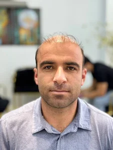 کلینیک ترمیم و پروتز مو علی ثابتی