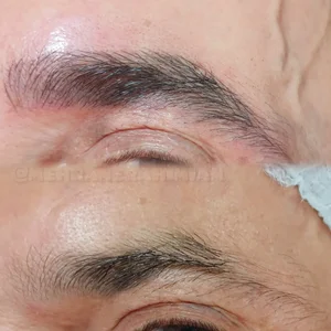 خدمات تخصصی میکروبلیدینگ ابرو 5