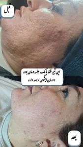 مرکز فیشیال آرزو نظیفی 2