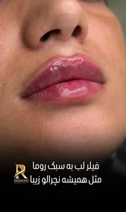 مرکز پزشکی زیبایی روما