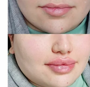 مرکز زیبایی ولیزر شقایق 3