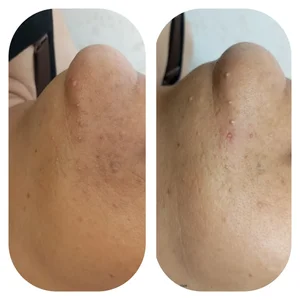 فیشیال و پاکسازی پوست ندا 3