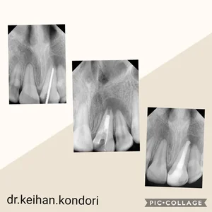 دندانپزشکی دکتر کیهان کندری 5