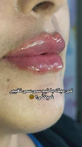 کلینیک پوست،زیبایی و لیزرماریسا 3