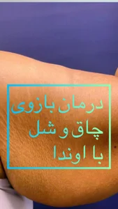 مرکز لاغری مدرن