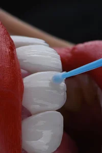 مطب دندانپزشکی دکتر مریم فراهانی(اقدسیه)
