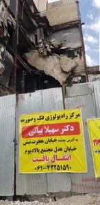 مرکز رادیولوژی فک و صورت دکتر سهیلا بیاتی 2
