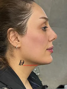 مطب زیبایی دکتر مریم آقاخانی 2