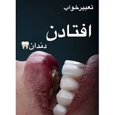 افتادن دندون جزو اون خواب هایی هست که به شدت همه ازش وحشت ...