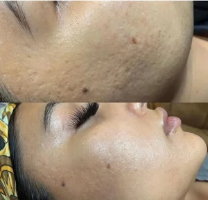 کلینیک فیشال و پاکسازی پوست اصفهان 2