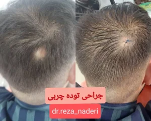 مرکز زیبایی و لیزر دکتر رضا نادری 3