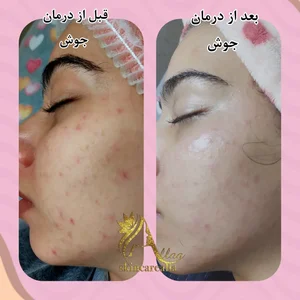 کلینیک پاکسازی وفیشیال پوست آلا بانو 4