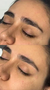 خدمات درماپلنینگ vip با اصلاح ابروی رایگان 3