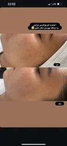 خدمات فیشال صورت و بدن طلوع 3