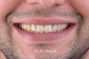 متخصص ارتودنسی دکتر کیوان انوش 2