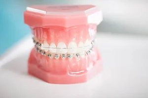 مطب تخصصی دندانپزشکی زیبایی دکتر مهسا سامانی