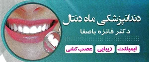 دندانپزشکی ماه دنتال