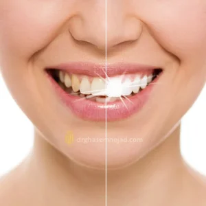 دندانپزشکی زیبایی