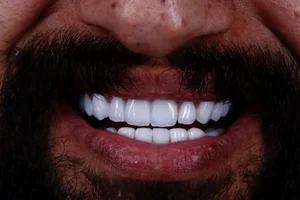 كلينيك دندانپزشكي بارانا 2